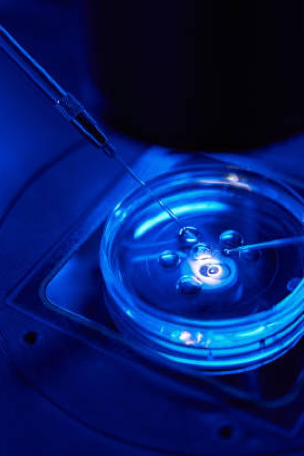 Spermatozoon is being injected into ovum with help of microneedle and holding pipette under microscope